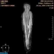 Scan [2] of bird mummy LB 1355 - X-ray.gif